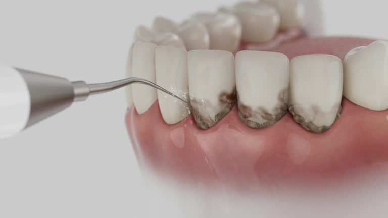 Reliable Emergency Dentist contractor in Henry County County, IN by Dentist Open Now
